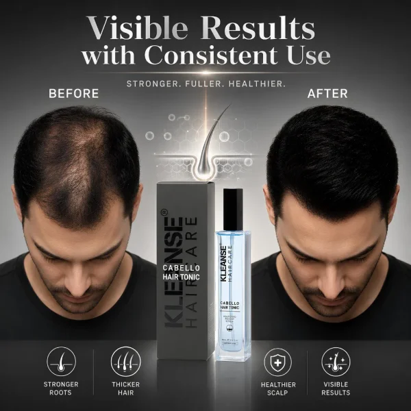 133 KLEANSE Cabello Hair Tonic Daily Hair Loss Spray Anti Hair Fall Treatment Anti Dandruff 100ml