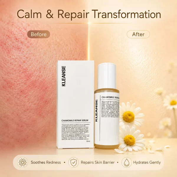 54 KLEANSE Chamomile Repair Serum Soothing Healing For Sensitive Skin Anti Redness Repair Skin Barrier 30ml