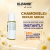 CHAMOMILE repair serum KLEANSE Chamomile Repair Serum Soothing Healing For Sensitive Skin Anti Redness Repair Skin Barrier 30ml