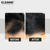 KLEANSE Cabello Hair Tonic Daily Hair Loss Spray Anti Hair Fall Treatment Anti Dandruff