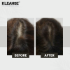 KLEANSE Cabello Hair Tonic Daily Hair Loss Spray Anti Hair Fall Treatment Anti Dandruff