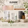 KLEANSE Acne Skin Solution Kit To Treat Acne Prone Pimple Skin Repair Soothe Clarify