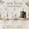 KLEANSE Acne Skin Solution Kit To Treat Acne Prone Pimple Skin Repair Soothe Clarify