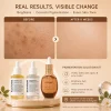 KLEANSE Pigmentation Solution Kit Correct Pigments Fades Dark Spots Brightens Dull Skin